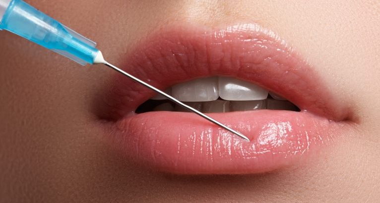 Five Reasons to Get Fillers o2nanomask
